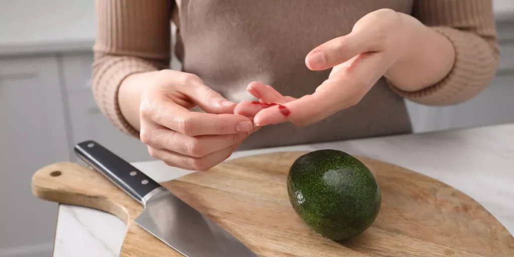 Suggerimenti rapidi per evitare infortuni comuni in cucina